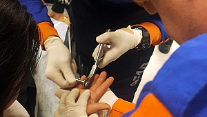 Parmağına Sıkışan Yüzüğü AFAD Ekibi Çıkardı