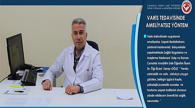 ÇOMÜ Hastanesinde Varis Tedavisine Ameliyatsız Yöntem
