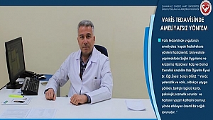 ÇOMÜ Hastanesinde Varis Tedavisine Ameliyatsız Yöntem