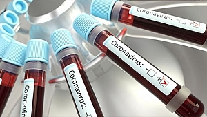 KORONAVİRÜSÜN YENİ BİR BELİRTİSİ DAHA AÇIKLANDI!