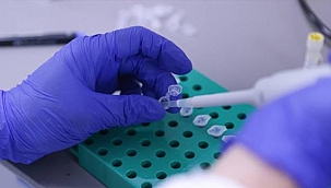 TÜBİTAK KORONAYI YIKIP GEÇECEK 2 YERLİ İLAÇ İÇİN TARİH VERDİ!